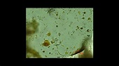 TROFOZOITO DE GIARDIA LAMBLIA - YouTube