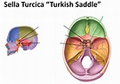 Sella Turcica Diagram | Quizlet