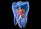 La Pulpa Dental: Funciones y Significado en la Salud Bucal - Clínica ...