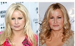 Jennifer Coolidge Plastic Surgery Before and After Photos 2023