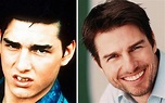 Tom Cruise Teeth - The Truth About The Actor's Distinctive Misaligned ...