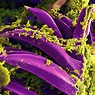 "Yersinia" Bacteria: Plague, Foodborne Illness, and Other Effects ...