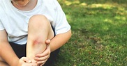 Bruised Muscle (Muscle Contusion): Symptoms and Treatment