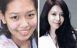 韓國女團少女時代整容前後照片，看誰的臉動得最多 - 壹讀