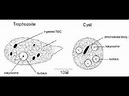 Trophozoite and Cyst of Entamoeba histolytica in LPCB mount - YouTube