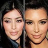 Antes y después Todas las operaciones de Kim Kardashian: antes y ...