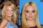 Emma Rigby plastic surgery before and after photos | Barbie | Emma ...