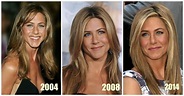 Jennifer Aniston Plastic Surgery: Before & After Photos ...