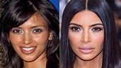 Kim Kardashian to the action: how the surgery transformed his body and ...