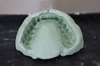Understanding Prosthodontics - Tagore Dental College & Hospital-By ...