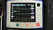 Instruction of the Zoll X Series - Part 3 (Basic EKG Monitoring) - YouTube