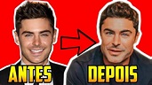 ZAC EFRON ANTES E DEPOIS | ZAC EFRON HARMONIZAÇÃO FACIAL - YouTube