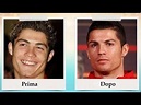 Cristiano Ronaldo prima e dopo - Solo i ricchi possono diventare belli ...