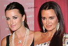 PHOTOS: See 'RHOBH' Kyle Richards Before & After Plastic Surgery Pics!