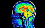 This Is Your Brain on Drugs (Really) | Live Science