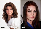 Priscilla Presley Plastic Surgery Disaster That Should Not Be Done ...