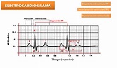 FISIOLOGÍA BÁSICA: Electrocardiograma (Interpretación, Eje Eléctrico)