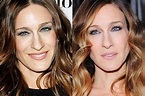 Sarah Jessica Parker Plastic Surgery Rumors – Before and After Pictures ...