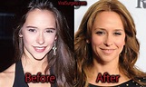 Jennifer Love Hewitt Plastic Surgery: Before and After Nose Job Pictures