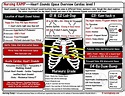 Heart Sounds Level 1 S1 S2 S3 S4 Murmurs | Nursing notes, Heart sounds ...