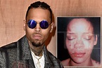 Chris Brown tells how he almost killed himself after Rihanna assault.