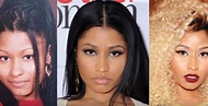 nicki minaj before and after Plastic Surgery | Top Piercings