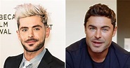 Zac Efron's Face Looks Totally Different As Fans Speculate Fillers ...