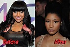 Real Nicki Minaj Before Surgery – Telegraph