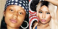 Cirugías de Nicki Minaj ¡Que cambios! - Cirugias.de