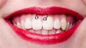 A Gum Piercing: What You Need To Know | Colgate®