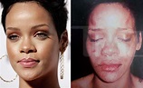 Web site posts photo it claims is a beaten Rihanna