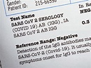 How Do I Get My COVID-19 Test Results? | MainStreet Family Care