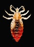 Effective Head Lice Treatment & Tactics: New Advice by Academy of ...