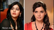 Did Samantha Ruth Prabhu Undergo Plastic Surgery Before After Channel ...