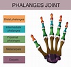 Name the type of joint between phalanges.