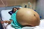 The truth behind the story of an Indian woman giving birth to 11 ...