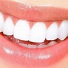 4 técnicas para tener dientes más blancos en poco tiempo: Todo lo ...