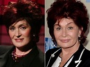 Sharon Osbourne before and after plastic surgery (44) – Celebrity ...