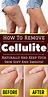 Pin on Exercises To Reduce Cellulite