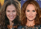 Amy Brenneman Plastic Surgery, Before and After Botox Pictures