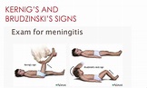 Kernig and Brudzinski Sign - MEDizzy