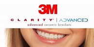 3M Clarity Advanced Bracket Set (SINGLE ARCH) – IAS Shop