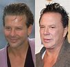 Mickey Rourke Plastic Surgery Face Before And After Photos