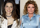 Shania Twain Plastic Surgery Before And After – Telegraph