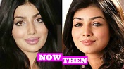Ayesha Takia Plastic Surgery Gone Wrong - Before And After - YouTube