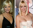 Anna Faris Plastic Surgery Before & After - Celebrity Plastic Surgery