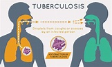 Tuberculosis enfermedad infeccioso crónico mas frecuente en el mundo