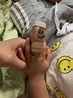 2歲男童手指被門夾到「皮肉裂開」！母控幼兒園安全出問題 - 生活 - 自由時報電子報