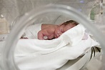 Número de partos de prematuros extremos pode ter diminuído em até 90% ...