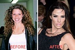 Celebrity before and after plastic surgery: shock transformations ...